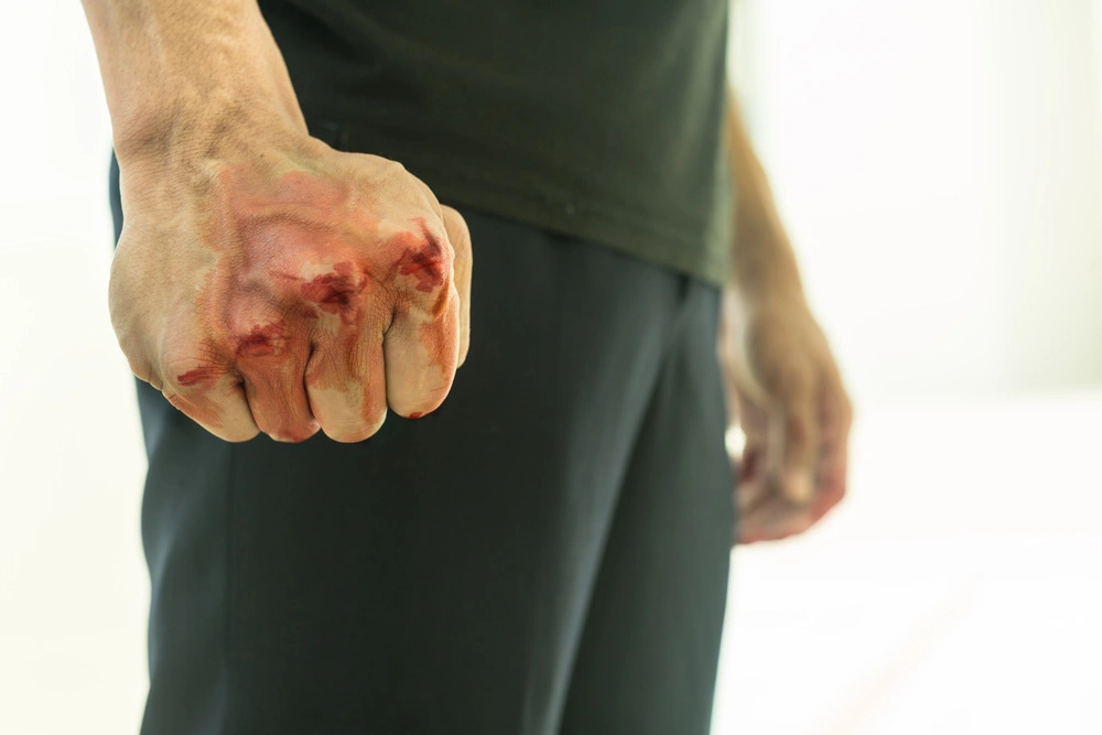 Aggressive violent man in a fight, with a bloody fist.