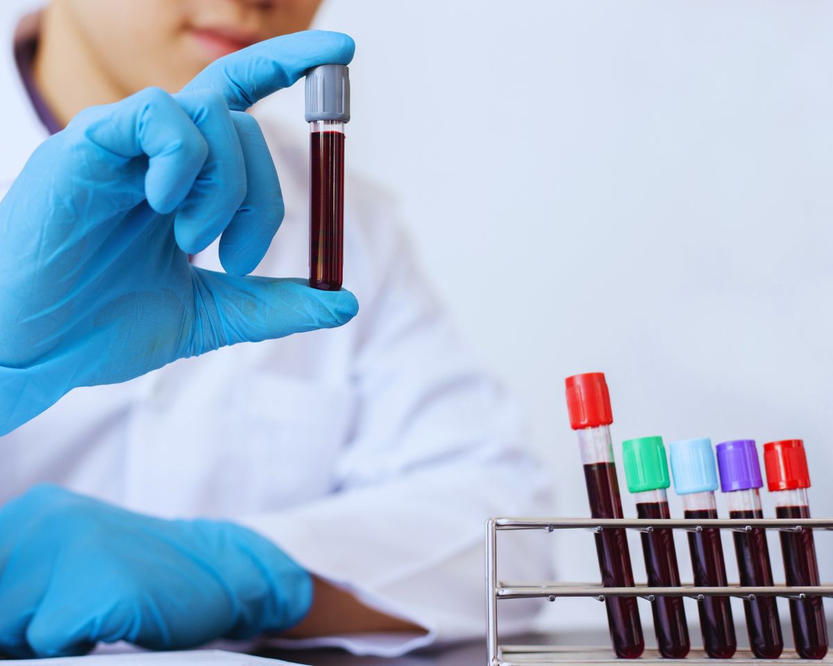 DUI BLOOD TESTING